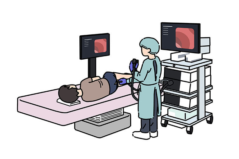 大腸内視鏡検査について